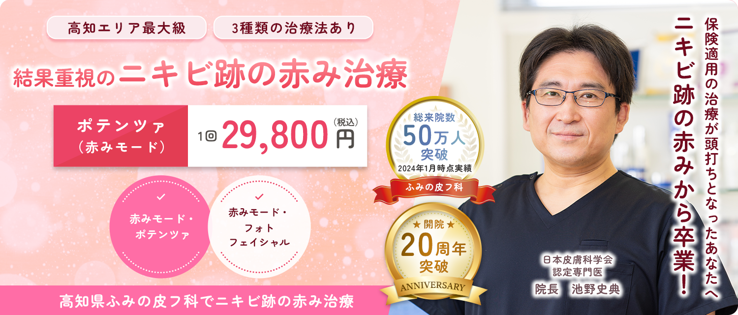 ニキビ跡の赤み治療のファーストビュー